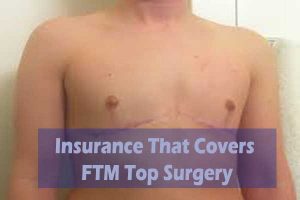 Insurance That Covers FTM Top Surgery