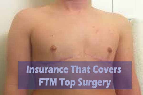 Insurance That Covers FTM Top Surgery