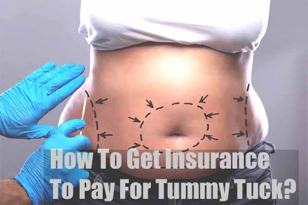 How To Get Insurance To Pay For Tummy Tuck?